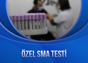 yilmaz-evde-serum
