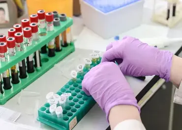sma-testi-nerede-yapılır